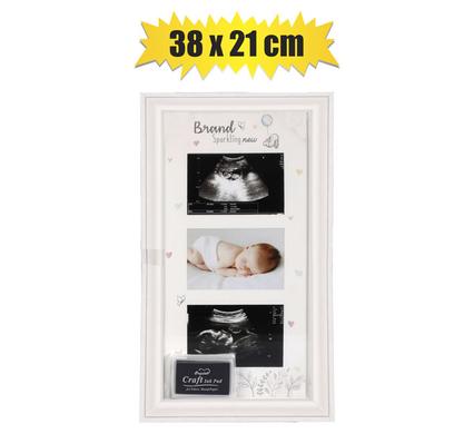 BABY SCAN PHOTO FRAME